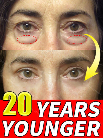 Instantly removes under eye bags,